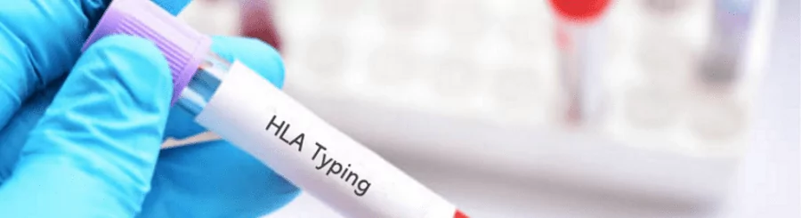 HLA Typing Blood Tube