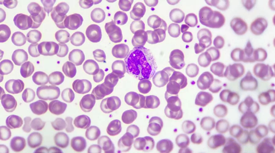 Monocyte under microscope wright stain