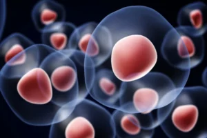 CAR T-Cell Therapy for Multiple Myeloma